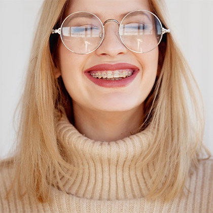 Tooth-coloured braces